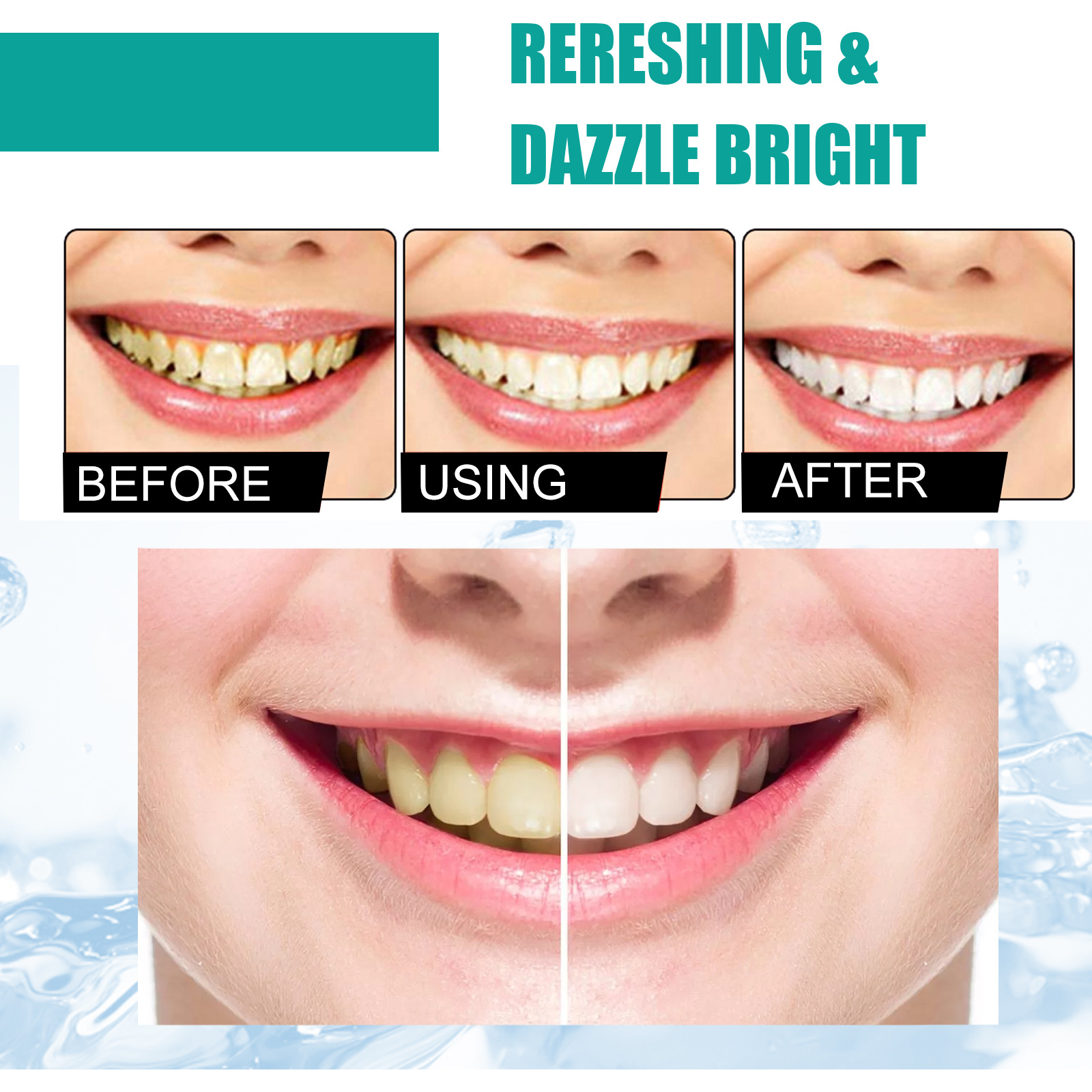 مسحوق أسنان النعناع نفس منعش 5 - مراجعة Teeth Whitening Near Me وسعره